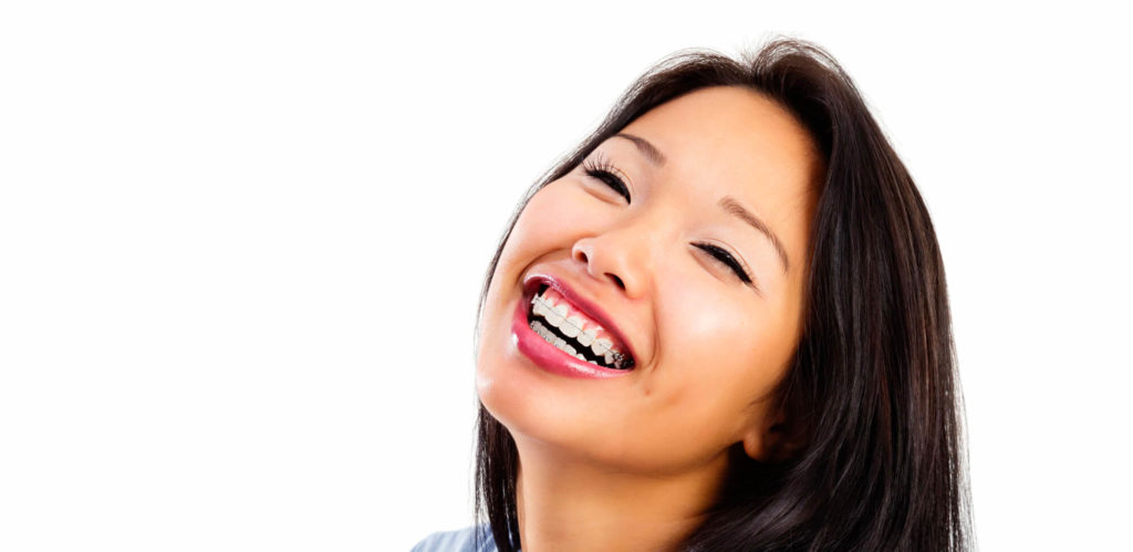 AdultBraces